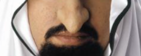 ACCESS: Nose, giant